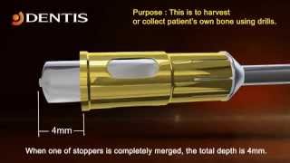 SAVE Bonechip Drill  Dentis Sinus Kits amp instruments [upl. by Pallua]