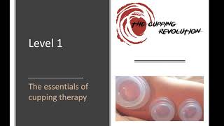 Essentials of Cupping Therapy Free Training [upl. by Notsa]