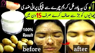 Natural remedies for pigmentation on face [upl. by Noivad]