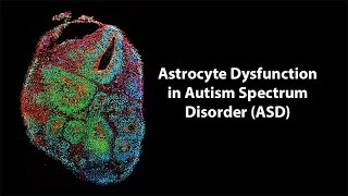 Astrocyte Dysfunction in Autism Spectrum Disorder ASD  Breaking News in Stem Cells [upl. by Enelyad]