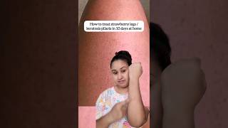 How to treat strawberry legs  keratosis pilaris in 10 days at home shorts youtubeshorts beauty [upl. by Saber]