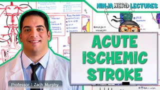 Acute Ischemic Stroke Etiology Pathophysiology Clinical Features Diagnostics Treatment [upl. by Etirugram527]