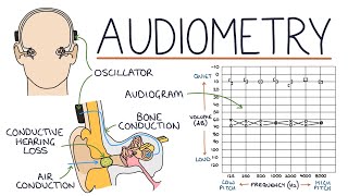 Understanding Audiometry and Audiograms [upl. by Horodko]