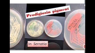 Prodigiosin pigment formation in Sarratia Serratia marcescens Prodigiosin [upl. by Caton620]