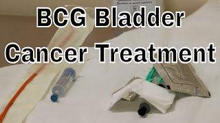 BCG Treatment for early Bladder Cancer chemo May 2016old version [upl. by Flori]