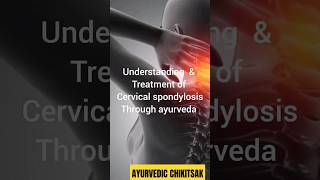 spondylosis treatment through ayurvedaspondylosisayurveda natural bams neckpain [upl. by Aicenert]