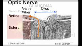 Eye Works 2 Image Retina Optic Nerve and Brain [upl. by Pansie268]