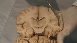 Cortical Localization Neuroanatomy Video Lab  Brain Dissections [upl. by Weinberg]