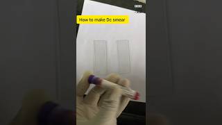 how to make toungh shape blood smear 😲🤯 bloods laboratory medical bloodtest vitalshorts [upl. by Assener]