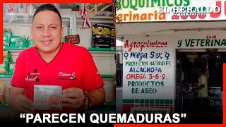 Caso del veterinario de Soledad “parecen quemaduras no mordeduras” [upl. by Immas314]