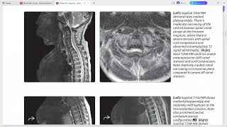 SPINE IMAGING DIAGNOSTIC IMAGING SERIES [upl. by Napoleon]