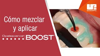 Cómo mezclar y aplicar el blanqueamiento dental médico Opalescence™ Boost™ [upl. by Alhan600]