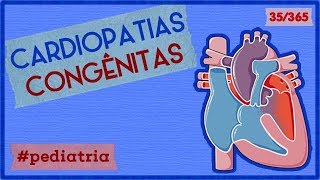 Cardiopatias Congênitas  PEDIATRIA  35365 [upl. by Lamag]