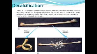 Decalcification of bone [upl. by Nannaihr]