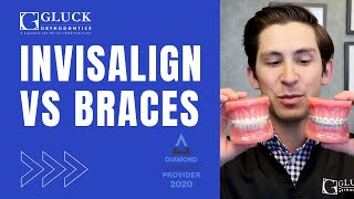 Invisalign vs Braces Tips from a Board Certified Orthodontist [upl. by Dust]