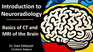 Basics of CT and MRI of the brain introduction to Neuroradiology [upl. by Yllet57]