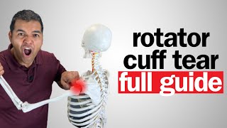 Rotator Cuff Tear Everything You Need To Know FULL 2024 GUIDE [upl. by Araht]