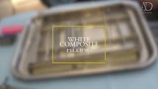 Worlds best White composite Filling filling Composite bonding Dentistry [upl. by Politi721]