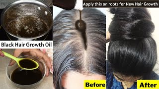 I Put👆🏼this Hair Growth Oil on Scalp To Grow Thick Dark Hair on Bald Areas Thinning Hair ampHair Loss [upl. by Frydman734]