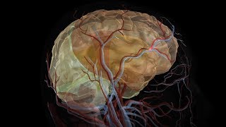 Stroke vs Aneurysm Different Symptoms Treatments [upl. by Akcirred]