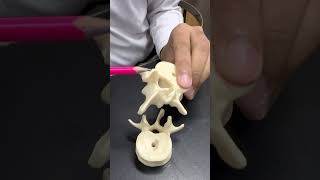 Atypical Lumbar Vertebrae L5  Anatomy  2nd Year MBBS [upl. by Enomas]