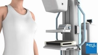 How a mammogram is carried out  Bupa Health [upl. by Finstad]