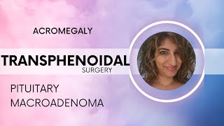 Acromegaly amp Transphenoidal Surgery [upl. by Alexei463]