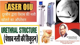 Urethral stricture  पेशाब नली की सिकुड़न  DrProfSantosh Kumar PGI [upl. by Tail338]