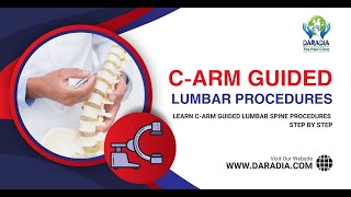 🎯CArm Guided Transforaminal Epidural Steroid Injection amp Facet Joint Injection StepbyStep Guide🚀 [upl. by Adamok]