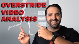 How Overstriding Impacts Your Running Video Analysis [upl. by Gaivn217]