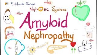 Amyloid Nephropathy  Kidney Pathology Lectures [upl. by Ardeid]