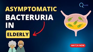 FRCPath Medical Microbiology Tutorials Asymptomatic Bacteriuria in Elderly [upl. by Ymmak]