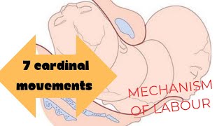 mechanism of labour obgyneLearning [upl. by Isus]