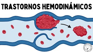 TRASTORNOS HEMODINÁMICOS Hiperemia Congestión Edema Efusión Hemostasia Trombosis y Embolismo [upl. by Jimmy]