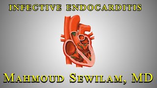 شرح ال Infective Endocarditis دكتور سويلم [upl. by Phil]