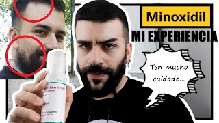 Minoxidil Barba  MI EXPERIENCIA  DREW SAYS [upl. by Ydollem]