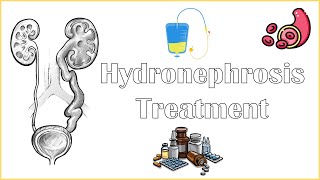 Hydronephrosis Treatment  Medical amp Surgical Management Of Hydronephrosis [upl. by Bourgeois]