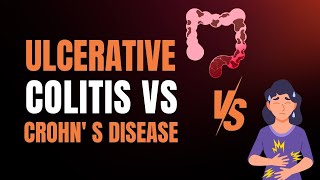 Ulcerative Colitis vs Crohns Disease Which Is Worse Find Out Now [upl. by Lucienne]