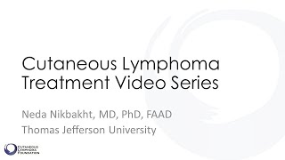 Cutaneous Lymphoma Treatment Series  Video 4 Systemic Therapies [upl. by Dammahom176]