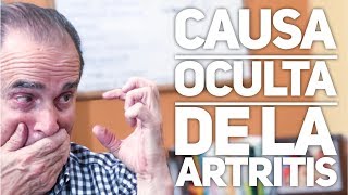 Episodio 1385 Causa Oculta De La Artritis [upl. by Sukin]