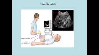 Echografie en MRI [upl. by Wahl892]