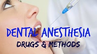 Dental Anesthesia [upl. by Potter]