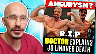 DOCTOR Explains Jo Lindner quotJoestheticsquot Death  Aneurysm [upl. by Kroll913]