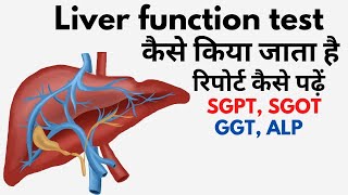 Liver function test in Hindi  lft blood test result in Hindi  lft normal range [upl. by Dillon377]