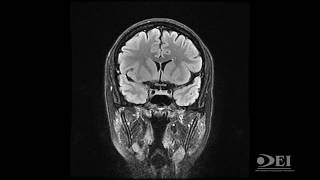 Resonancia Magnética Neurología Guadalajara Jal Mx [upl. by Gerty]