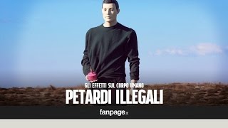 Gli effetti devastanti di un petardo illegale sul corpo umano [upl. by Ralfston]