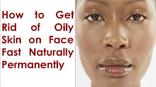 How to Get Rid of Oily Skin on Face Fast Naturally Permanently [upl. by Sokram941]