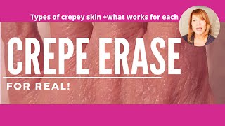 Crepey Skin Eraser for Real Types of Crepey Skin  How to Repair [upl. by Llewoh]