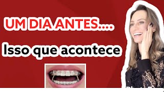 Quem nunca😅😂 aparelhoortodôntico elasticos aparelho dentista [upl. by Eldoree332]