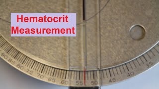 Hematocrit Measurement [upl. by Hutchings7]